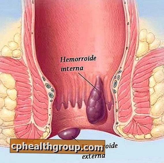Hemomax