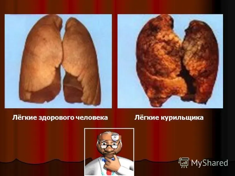 Nefro aktiv : gdje kupiti u Srbiji, u apoteci?